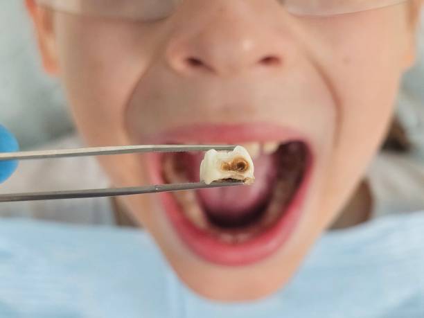 Best Urgent Tooth Repair  in Fern Park, FL